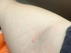 -复旦大学附属华山医院(总院)