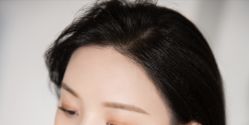 点击看大图 -大麦微针植发丨全国连锁