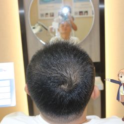 -大麦微针植发丨全国连锁