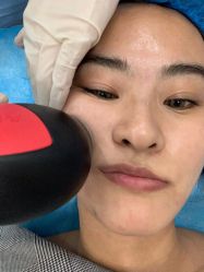 体验前-瑞鑫创美·高定轻医美