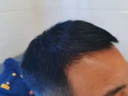 -雍禾植发全国连锁