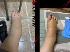 -大韩庄韩氏祖传正骨