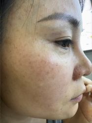 -长沙雅美医疗美容医院