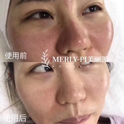 -MLP美丽派·问题肌疗愈中心