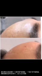 -悦己医疗美容整形线雕提升专门店