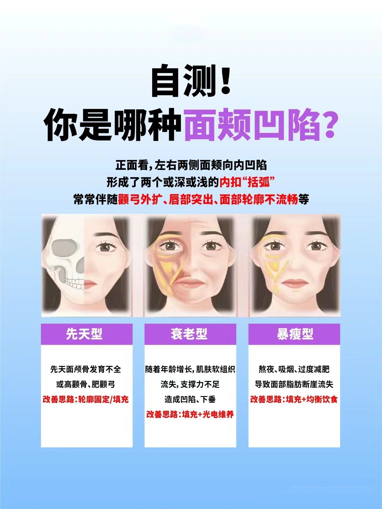 面颊凹陷根据形成原因,分为3个类型;
根据凹陷