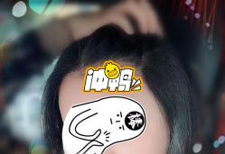 -大麦微针植发全国连锁