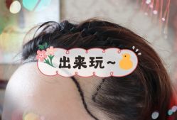 -大麦微针植发全国连锁