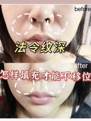 -厦门美莱整形美容医院