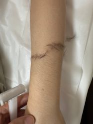 -薇兰专业脱毛连锁机构