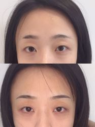 -MIVI半永久纹眉绣眉