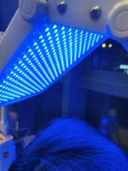 -碧莲盛·不剃发植发