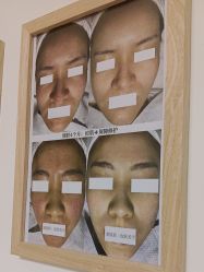 -美肤盾祛痘·问题肌头疗管理中心