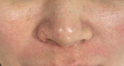 点击看大图 -MLP美丽派·问题肌疗愈中心