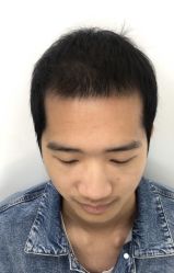 -发饰美男士增发补发假发定制店