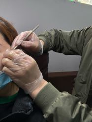 -百年美肤堂祛痦痣祛斑祛疣