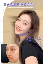 -北京米扬丽格医疗美容·联合丽格鼻整形中心