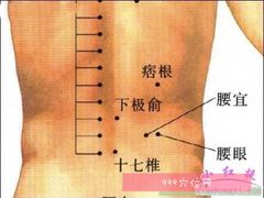 -裕和堂中医推拿艾灸(太古汇臻品店)