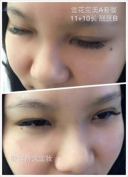 睫毛嫁接-光SPA科技美肤