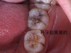 -固瑞齿科·口腔·种植·矫正(恒隆分院)