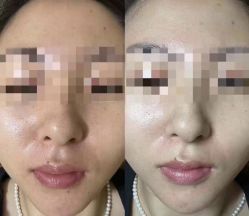 -SKIN79皮肤管理中心