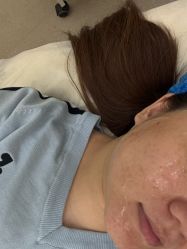 -BR光电保养