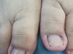 -世龙世家手足健康护理连锁(福田梅林路润裕花园店)