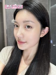 -深圳艺星医疗美容医院
