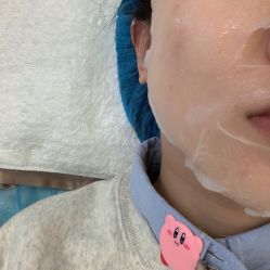 体验后-武汉颜范薇美医疗美容门诊部