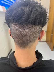 点击看大图 -大麦微针植发全国连锁