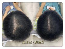 -金尚丝接发