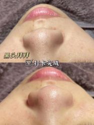 -美肤盾祛痘·问题肌头疗管理中心