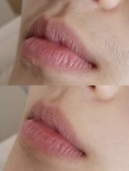 -HEYAN荷妍专业脱毛连锁机构