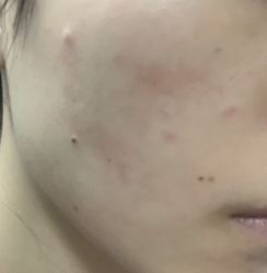 -La Rose·轻奢皮肤管理