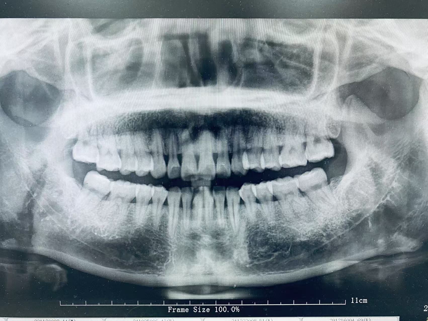 第一次来拍牙片!
