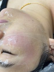 -长沙雅美医疗美容医院