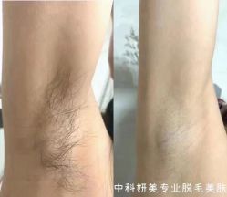-中科妍美专业脱毛美肤连锁机构