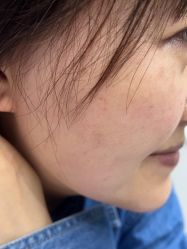 -广州美莱医疗美容医院