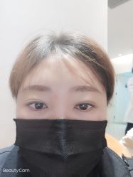体验后-天津伊美尔医疗整形美容专科医院