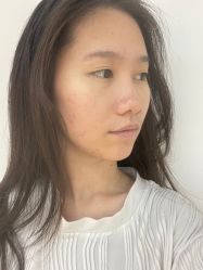 -广州美莱医疗美容医院