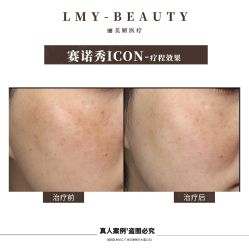 -丽美妍医疗美容·皮秒·立体分层抗衰