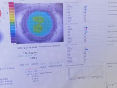 -上海大学附属上海和平眼科医院