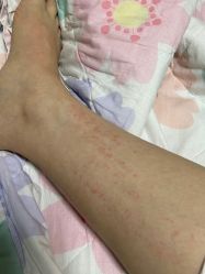 体验后-美莱医学美容医院