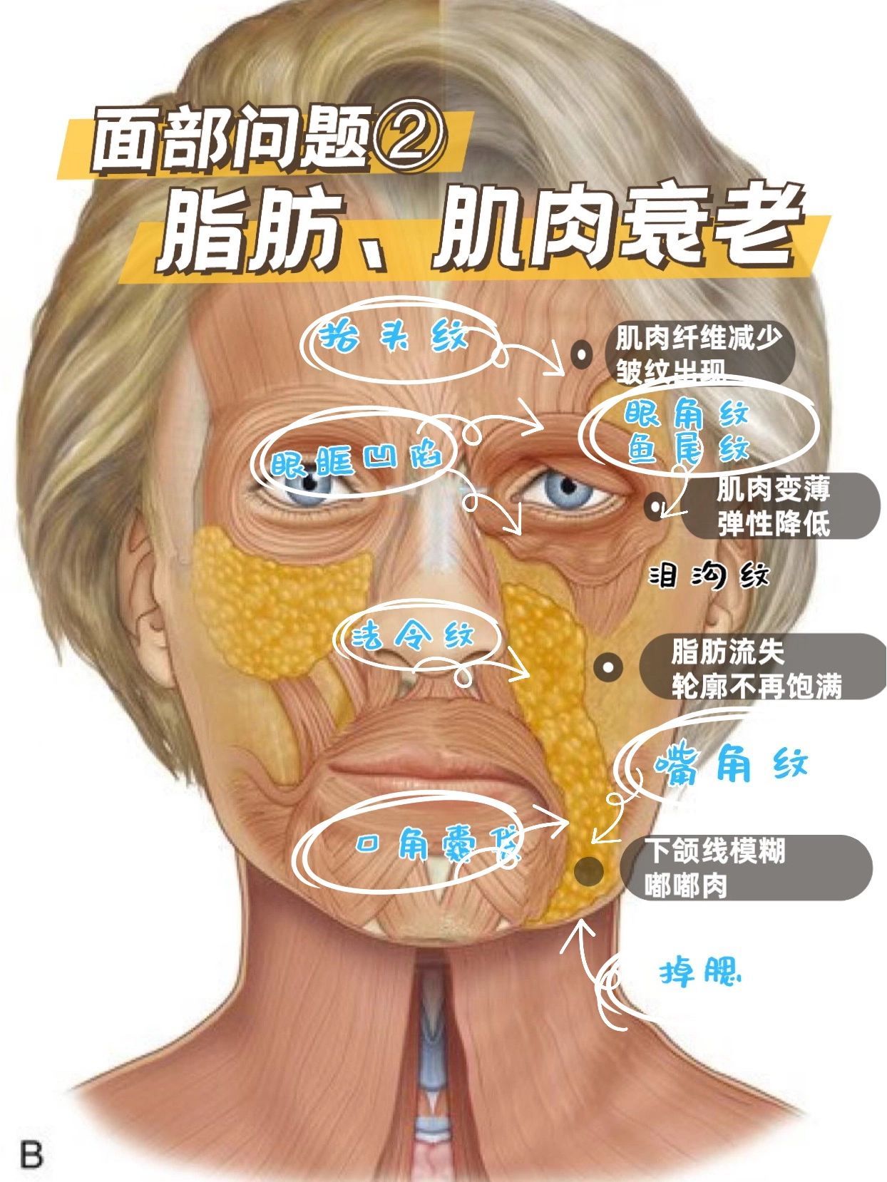 拨筋笔记96面部脂肪7715肌肉和衰老的关系