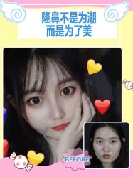 -广东韩妃整形外科医院