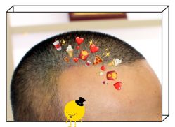 -大麦微针植发全国连锁