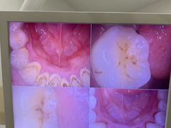 -土豆口腔(凤凰北总店)