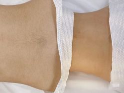 -薇兰专业脱毛连锁机构