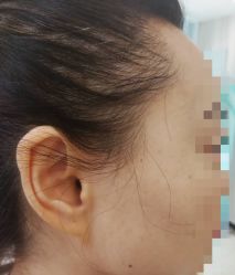 -新美荟医美·专注面部美学抗衰