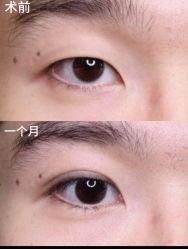 -长沙雅美医疗美容医院
